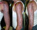 , my arm